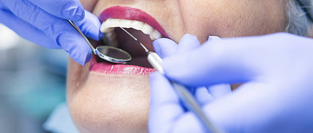 Best Emergency Dentist for Knocked-Out Tooth in Elon, NC