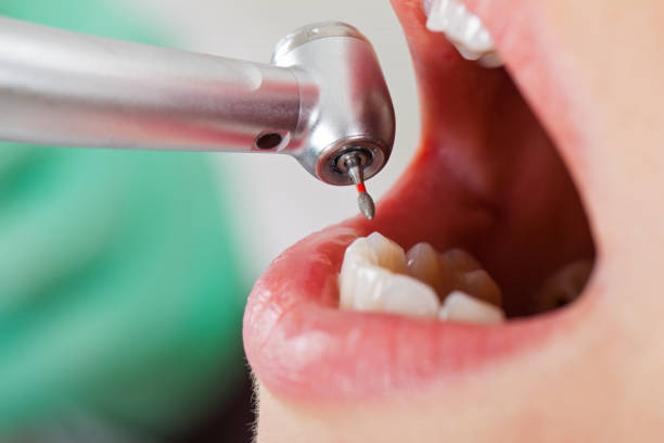 Best Emergency Cosmetic Dentistry in Elon, NC